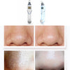 Hot&Cold Facial Vacuum Suction Blackhead Remover